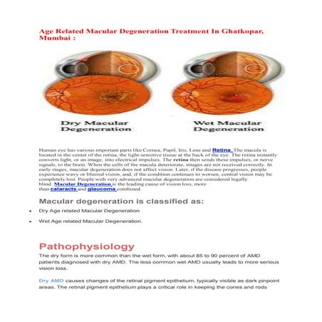 Age Related Macular Degeneration Treatment In Ghatkopar, Mumbai
