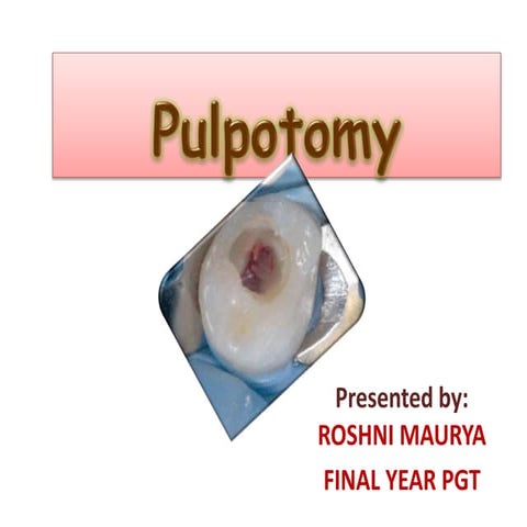 Pulpotomy