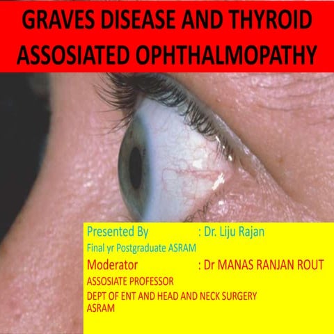 Graves disease and Thyroid eye disease with orbital decompression | PPTX