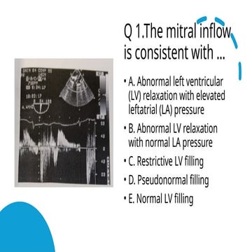 LV diastolic dysfunction explained concisely | PPTX