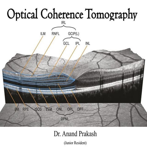 Optical Coherence Tomography - Dr. Anand Prakash (MS Ophthalmology).pptx
