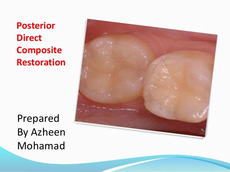 posterior direct composite restoration composite restoration