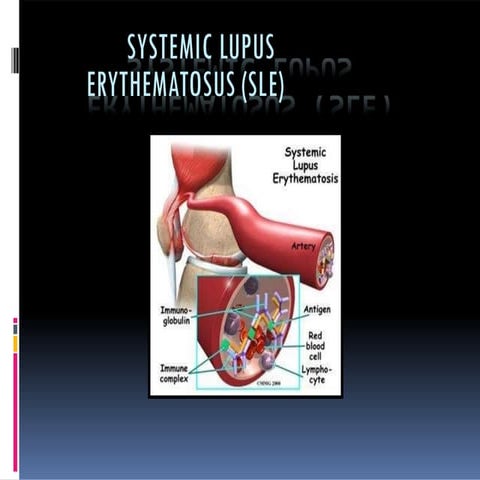 the detalied description and treatment of sle.pptx