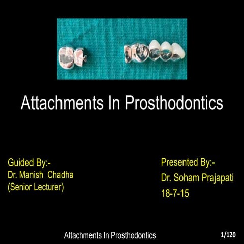 Attachments In Prosthodontics