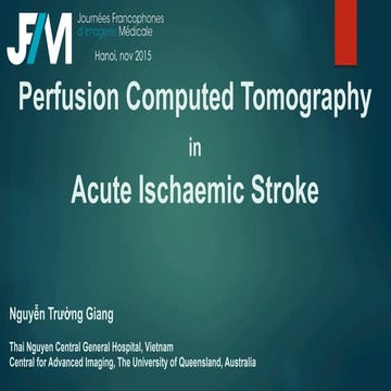 Nguyen trường giang perfusion computed tomography in acute ischaemic strok...