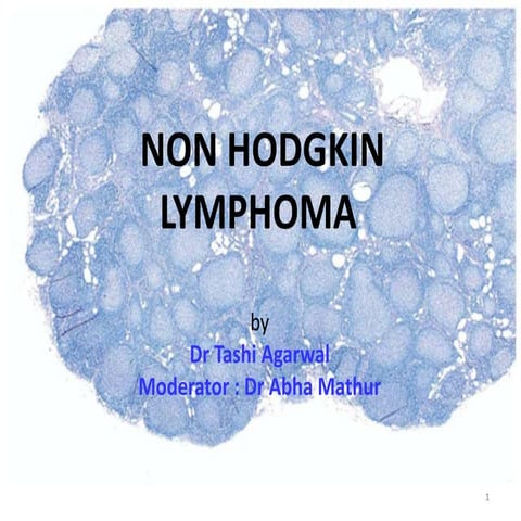 Non hodgkin lymphoma