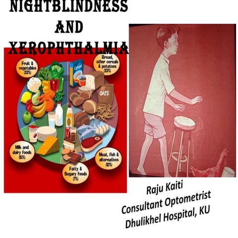 Nightblindness and xerophthalmia