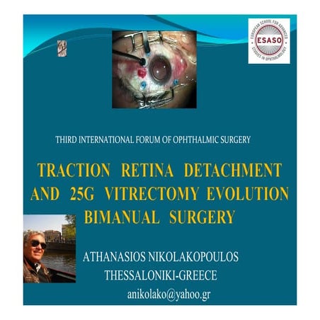 Vitrectomy Principles | PPT