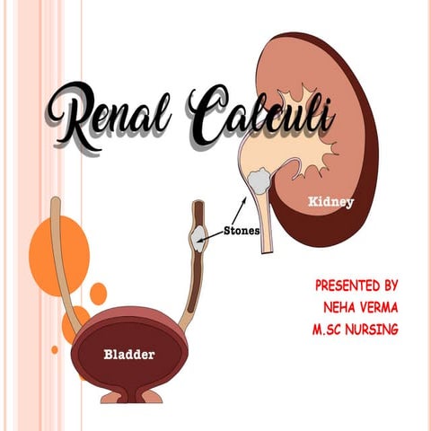 NEHA VERMA renal calculi ppt.pptx