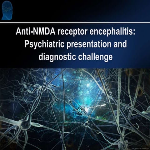 Anti-NMDA receptor encephalitis: Psychiatric presentation and diagnostic challenge
