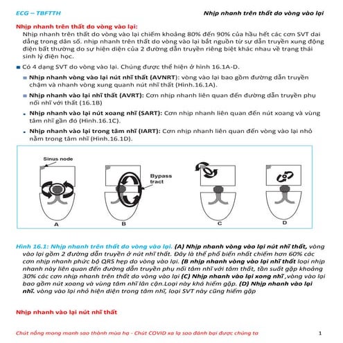 Nhịp nhanh trên thất do vòng vào lại slideshare