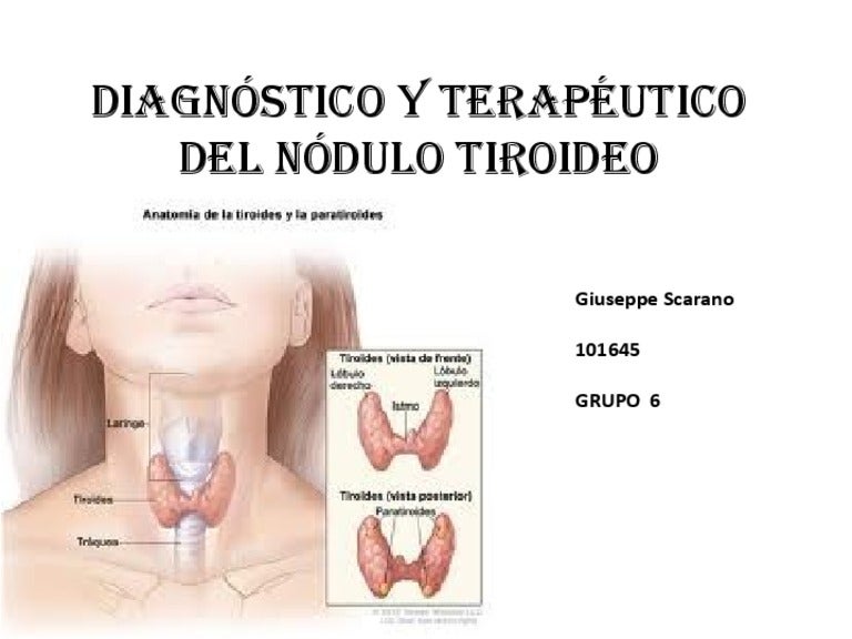 cuando se theater un nodulo de tiroides
