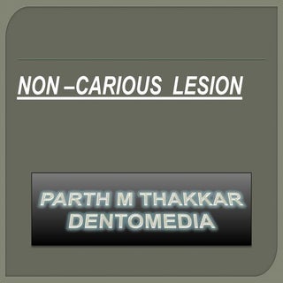 Non  carious lesion