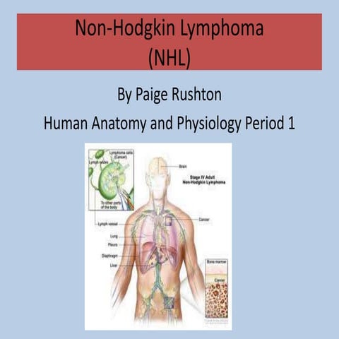 Non hodgkin lymphoma | PPTX