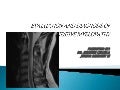 Non compressive myelopathy