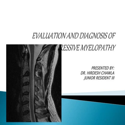 Non compressive myelopathy