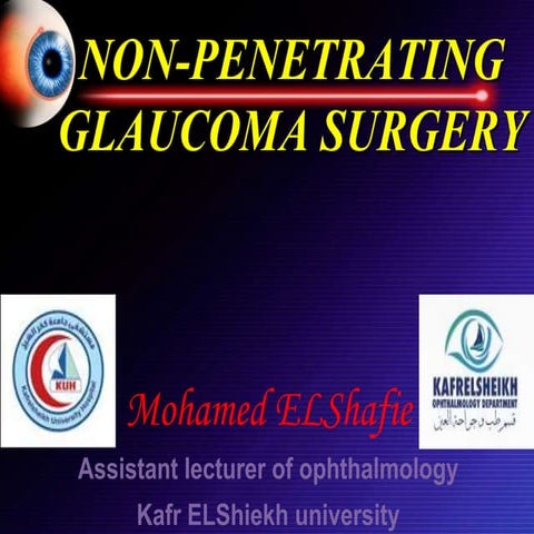 Nonpenetrating glaucoma surgery