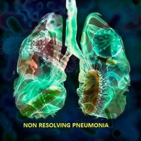 NON RESOLVING PNEUMONIA