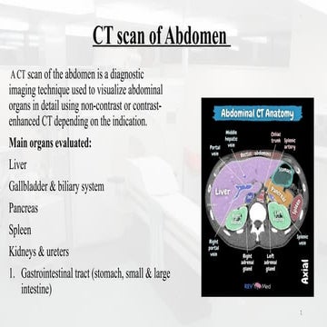 Abdominal CT scan | PPTX