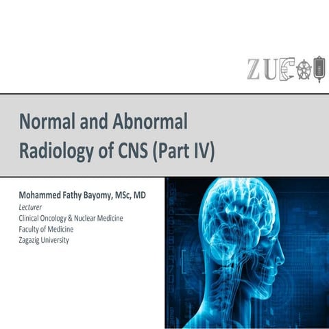 Normal & abnormal radiology of brain part iv