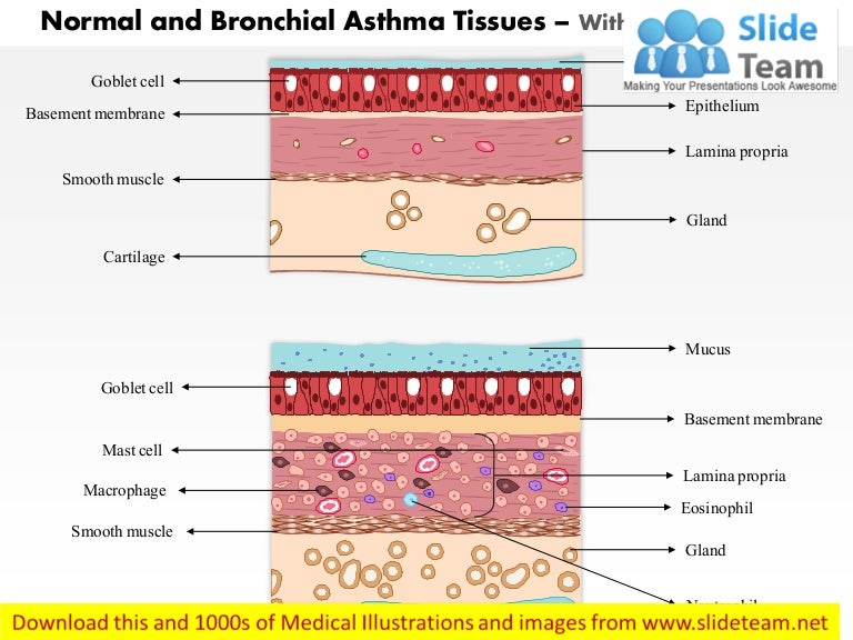 Normal and bronchial asthma tissues medical images for ... skin system diagram 