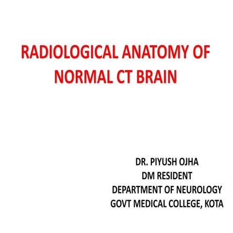 Normal CT BRAIN