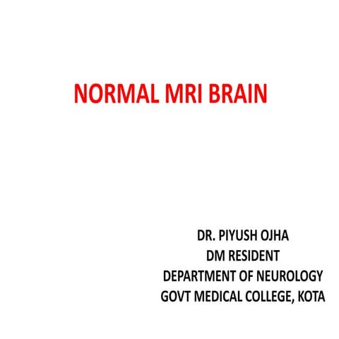Normal mri brain
