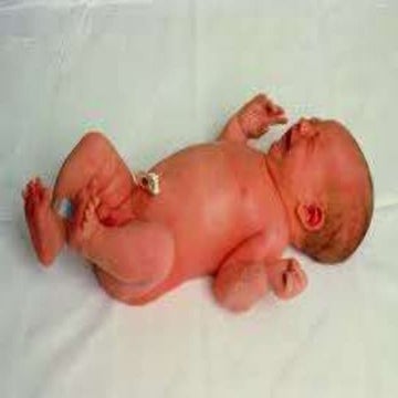 NORMAL NEWBORN.pptx