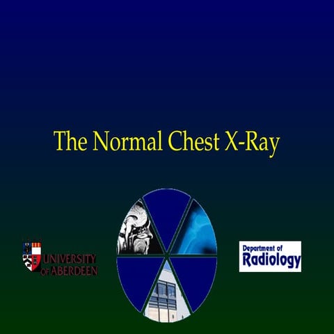 normal chest  radiohgraphy interpretation .ppt