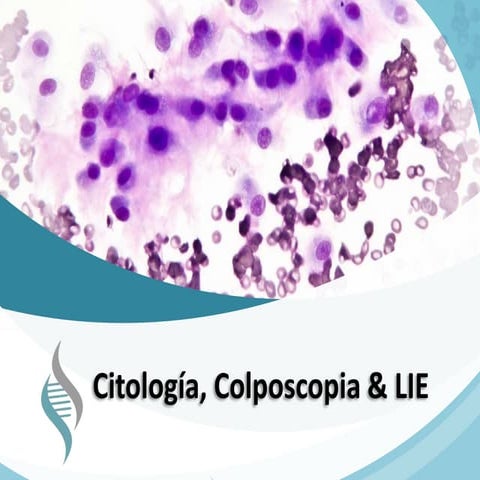 Norma tecnica para la deteccion temprana del cancer cervicouterino