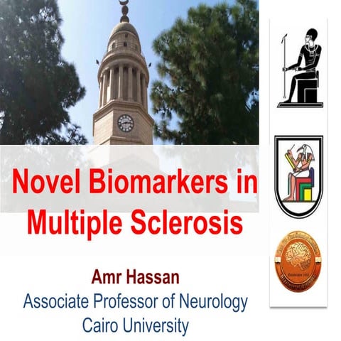 Novel biomarkers in Multiple sclerosis