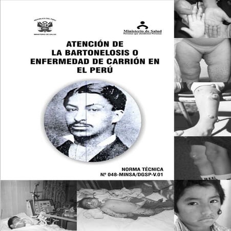 NT Bartonelosis 2007