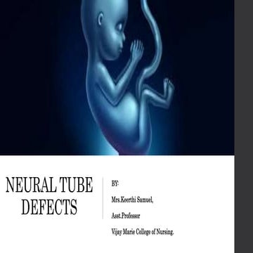 Neural tube defect | PPTX
