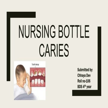 Nursing bottle caries.pptx