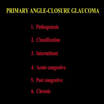 29 primary angle closure glaucoma
