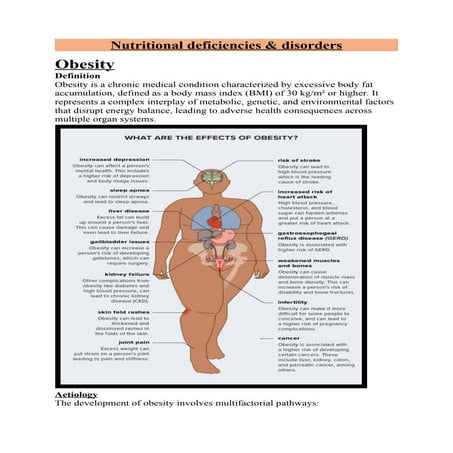 Nutritional deficiencies & disorders.docx PGDEI UNIT -3 sub topic