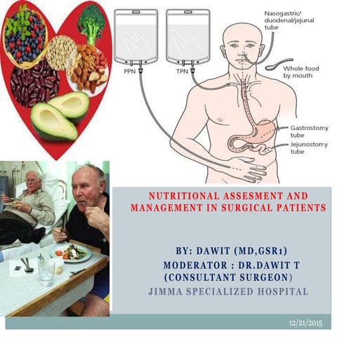 Nutrition in surgery
