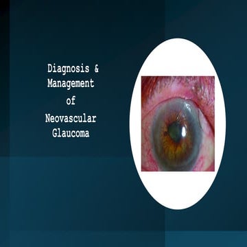 How to deal with Neovascular glaucoma cases