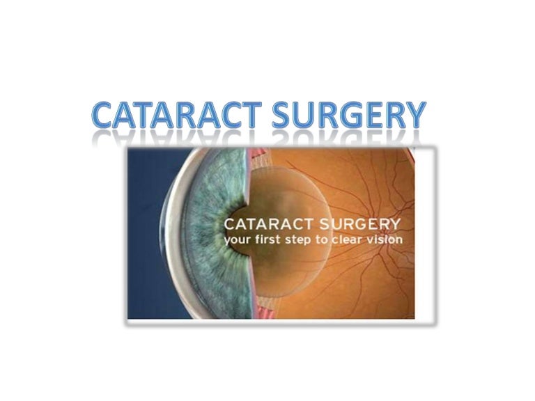 Cataract Removal Surgery & Treatment
