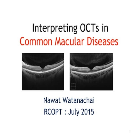 Nw2015 rcopt oct_retina22