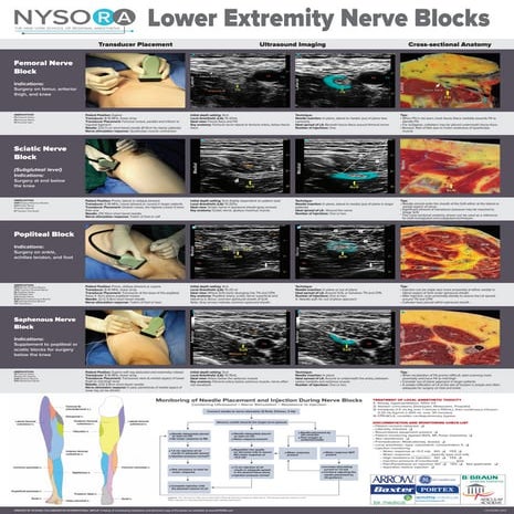 NYSORA-Lower-Extremity.pdf
