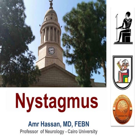 Nystagmus