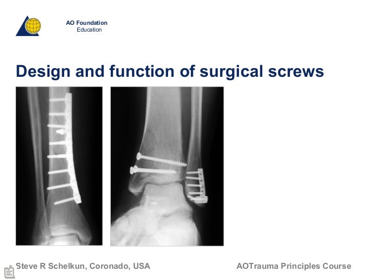 Design and function of surgical screws