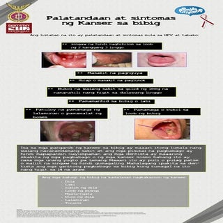 O.ca 02 signs and symptoms 3 aa3