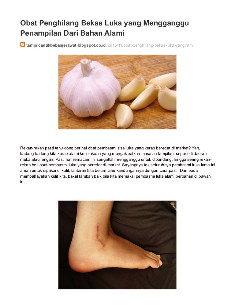 Obat Penghilang Bekas Luka Dari Bahan Alami