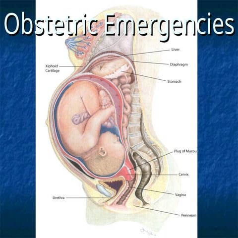 Obstetrics and Gynacologic emergencies.ppt