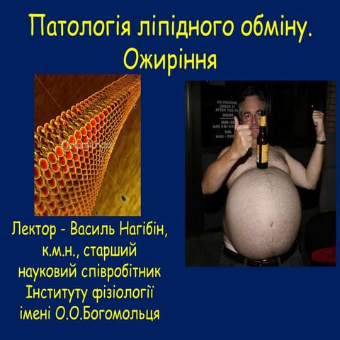 Патологія ліпідного обміну. Ожиріння. Lipids metabolism disorders.Obesity