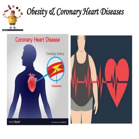Obesity Coronary Heart Diseases Ppt