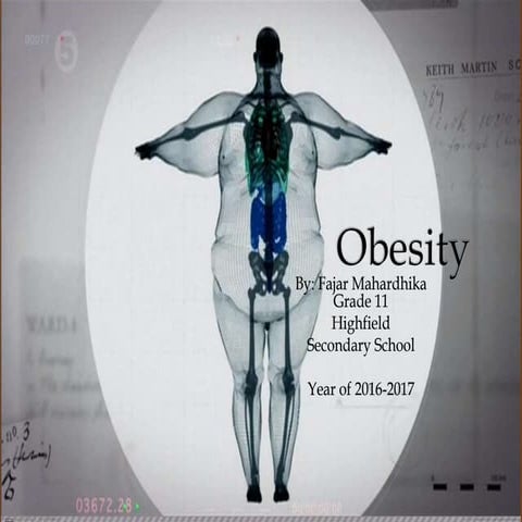 Obesity 