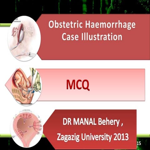 Obstetric hemorrhage cases and MCQ for undergraduate